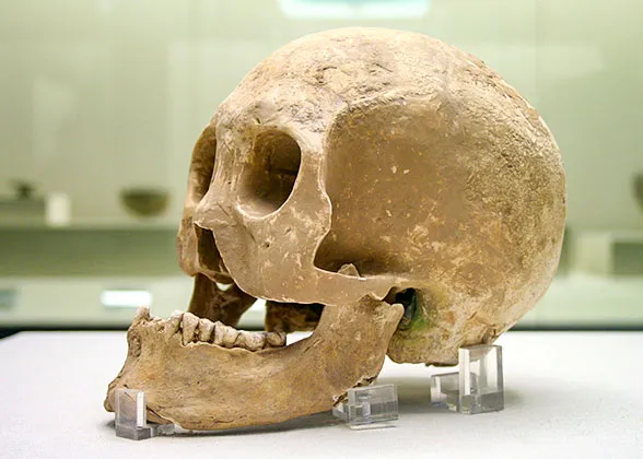 Skull Unearthed from Slaughter Pits